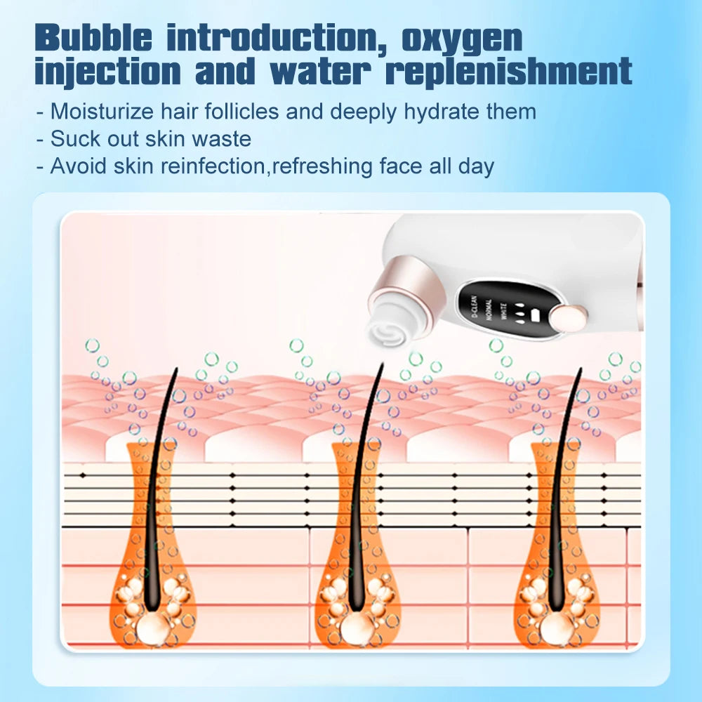 Vacuum Blackhead Remover