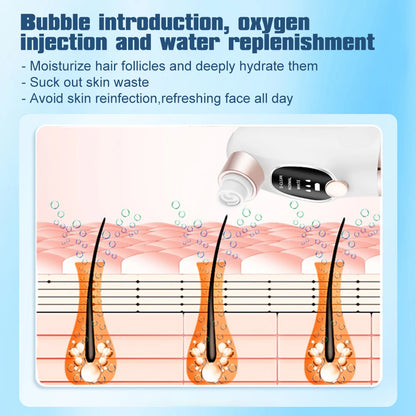 Vacuum Blackhead Remover