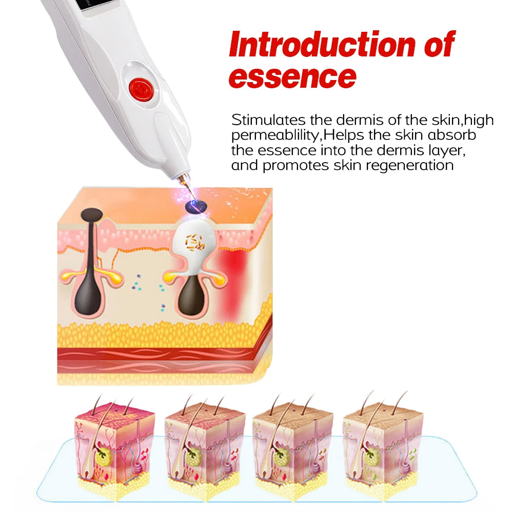 Electric Plasma Pen