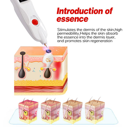 Electric Plasma Pen
